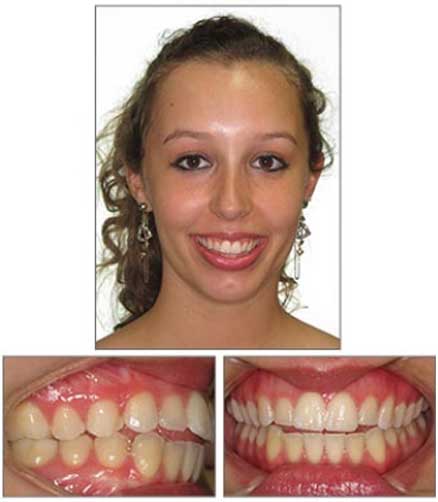 Sellers Orthodontics - Charlotte, NC Braces & Invisalign