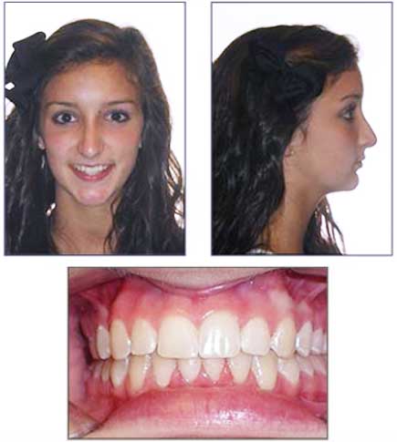 Sellers Orthodontics - Charlotte, NC Braces & Invisalign